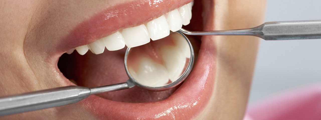 Czego oczekuje pacjent chcący mieć wszczepione implanty zębów?