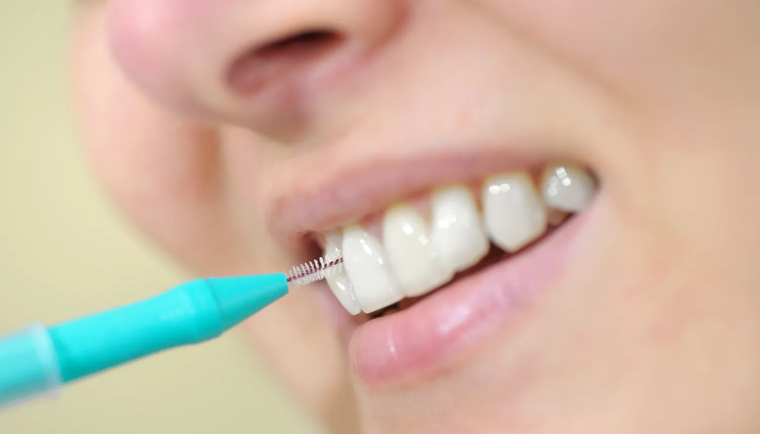 Kiedy leczenie kanałowe zęba?